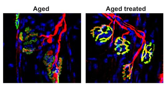 images showing the effect of the treatment on neuromuscular junctions