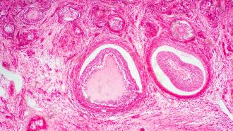 an image of an ovary under a microscope