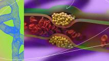 An image of a blood vessel with an arrow pointing to it, illustrating the potential for CRISPR therapy in cholesterol treatment.