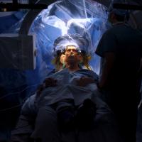 deep brain stimulation