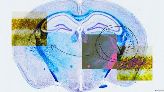 a collage featuring a mouse brain and microscope images of cells